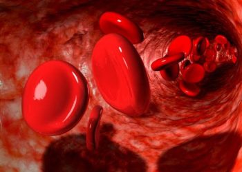 Ghana secures 5-year deal to use Novartis’ drug for sickle cell treatment