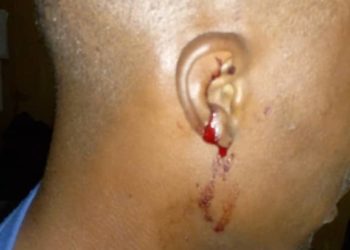 ASAWASE MP, MUNTAKA MUBARAK, SLAPS NPP GIRL