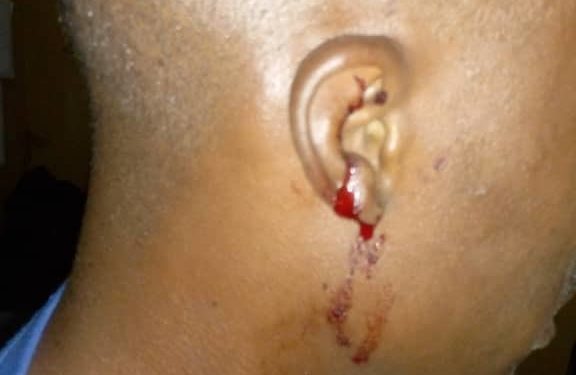 ASAWASE MP, MUNTAKA MUBARAK, SLAPS NPP GIRL