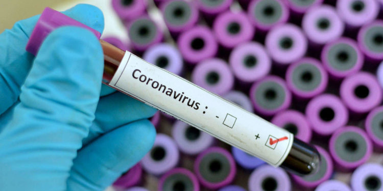 Government releases $100 million dollars for coronavirus fight- Prez. Akufo-Addo announces