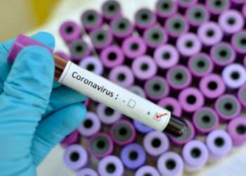 Breaking News: Two cases of coronavirus confirmed in Ghana