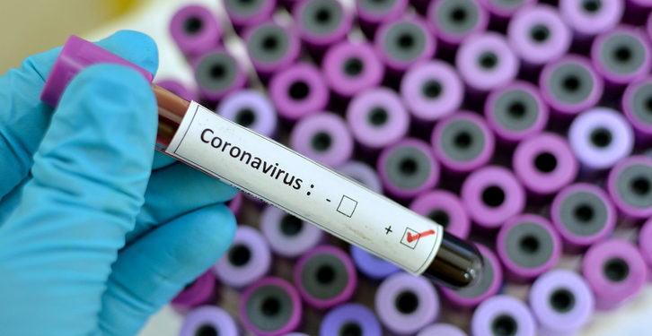 Breaking News: Two cases of coronavirus confirmed in Ghana