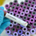 Breaking News: Two cases of coronavirus confirmed in Ghana