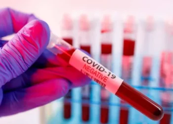 COVID-19: Ghana’s active cases now 1,064